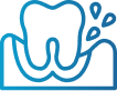 Symptoms of Gum Disease