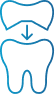 Dental Crowns (caps)