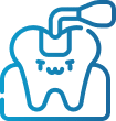 Dental Sealants