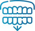 Braces and Clear Aligners