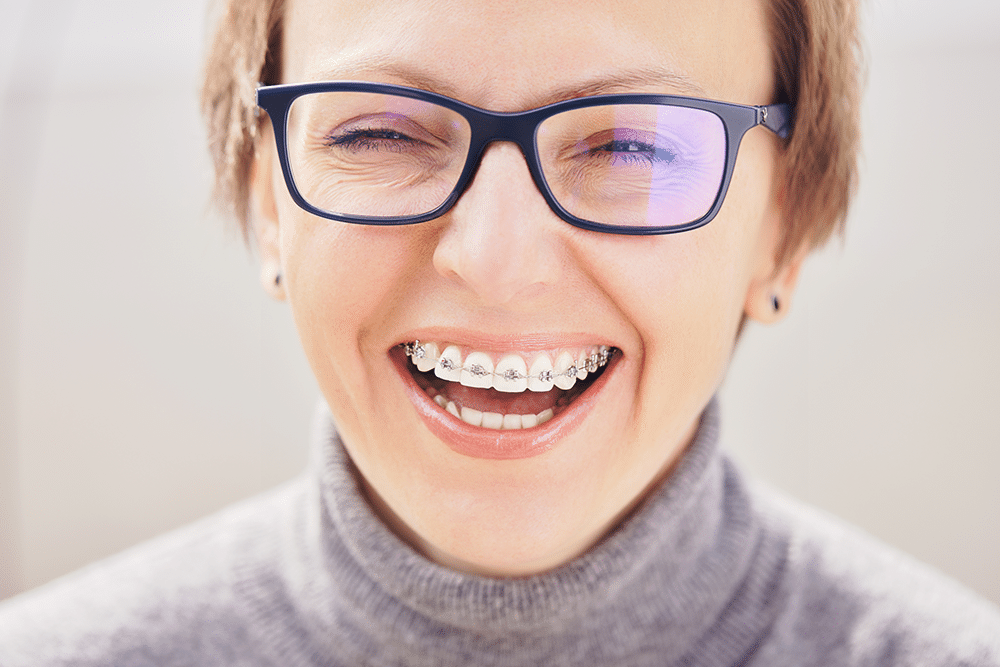 The Benefits of Braces