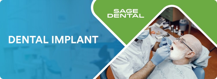 Dental Implant Offer, $500 Off Dental Implants
